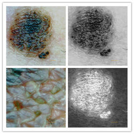 Skin Inspector Cyfrowy mikroskop Analizator skóry Aparat do skóry i skóry głowy o rozdzielczości 5 mln pikseli
