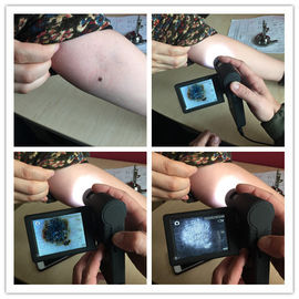 Profesjonalny elektroniczny wizjer dermatoskopowy do skóry z kartą Micro SD