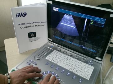 PC podstawie B / W Przenośny ultrasonograf 15 calowy ekran laptopa Tylko 5kgs Waga wygodny w przenoszeniu