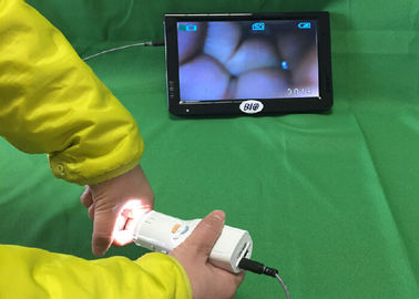 X 1,5 Powiększenie cyfrowe elektroniczne Kolposkop podłączyć do telewizora lub komputera lub monitora medycznego dla Zdrowia Kobiet