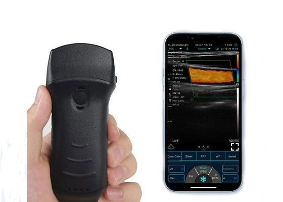 305mm Wifi przenośny ultrasonograf pęcherza moczowego wypukły + liniowy + sonda serca