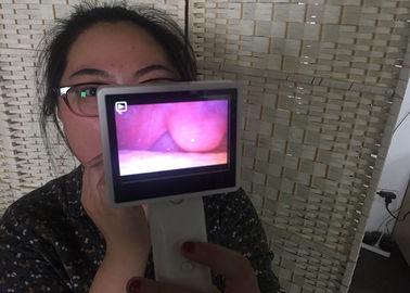 Endoskopia laryngologiczna Rhinoscopy Medyczna kamera wideo Otoskop cyfrowy do kontroli nosa za pomocą ekranu LCD