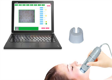 Inteligentny dermatoskop wideo Kamera skóry twarzy Inteligentny analizator skóry HD