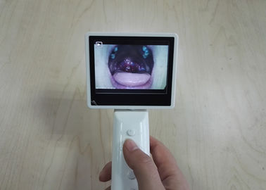 Cyfrowy aparat do laryngoskopu do krtani nosowej z ekranem LCD 3,5 cala