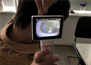 Handheld Digital Video Otoskop Dermatoskop Oftalmoskop Z Wysokiej Rozdzielczości