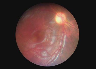 Okulistyczny sprzęt optyczny Gardło Kamera Wideo Otoskop Dermatoskop Endoskop cyfrowy z 2 milionami pikseli