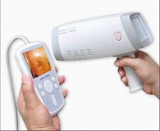 Cyfrowy Handheld szyjki aparatu Kolposkop dla Ginekologii wglądu do szyjki z 80,0000 pikseli 1 ~ 128 zoom