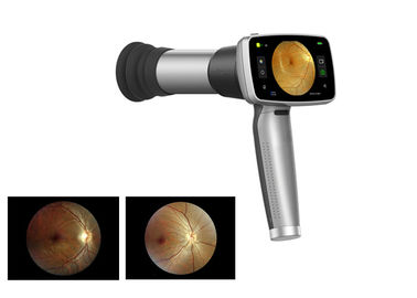 Wideoftalmoskop ręczny 45 ° z dnem oka