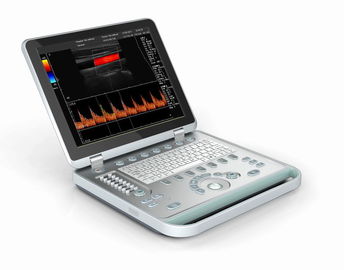 Lekka przenośna ręczna ultrasonografia dopplerowska 3D z 15-calowym ekranem LED
