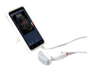 Przenośna ultrasonograf Doppler o wysokiej rozdzielczości z 6 calowym ekranem dotykowym