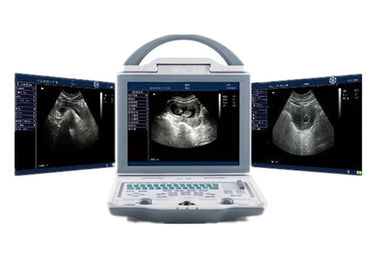 Ultradźwiękowa maszyna szpitalna Przenośny skaner ultradźwiękowy z podwójnymi złączami sondy