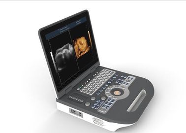 Medyczna maszyna ultradźwiękowa Przenośny ultrasonograf 4d Sprzęt ultradźwiękowy