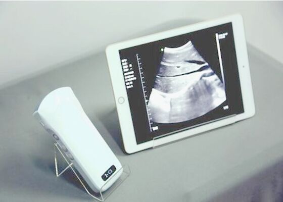 Windows Pocket Ultrasound Scanner Machines Elektroniczna macierz fazowa