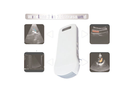 Ultradźwiękowy ultrasonograf z kolorowym dopplerem z wbudowanym sygnałem WiFi Bezprzewodowe ładowanie częstotliwości 2,5 MHz ~ 10 MHz