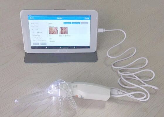 Digital Video Kolposkop kobieta opieki dla 10 lub 7-calowy monitor medyczny profesjonalnych kamer do inspekcji szyjki macicy