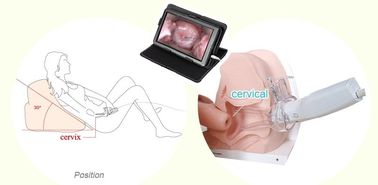 Ginekologiczny endoskopowy cyfrowy kolposkop medyczny dla kobiet do użytku domowego