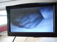 Wyświetlanie obrazów naczyniowe żył w ekranie podczerwieni Vein Finder dla pielęgniarek i lekarzy