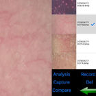 Wifi Tester skóry i skóry głowy Bezprzewodowy cyfrowy analizator skóry z 8-calowym ekranem 9 zdjęć wyświetlanych