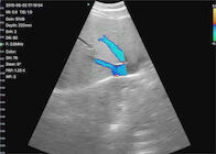 Cyfrowe przenośne ręczne przenośne urządzenie ultrasonograficzne Convex + Linear + Cardiac 3IN1 Bezprzewodowy przetwornik ultradźwiękowy