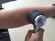 Dostosowane Health Care Handheld medyczna Dermatoskop dla Inspekcji skóry