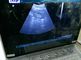 3D Cyfrowy B / W Przenośny ultrasonograf o wypukłym liniowe przezpochwowe Sondy