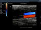 15-calowy dotykowy LCD 2D ultradźwiękowy kolor Dopple Przenośny diagnostyczny aparat ultradźwiękowy