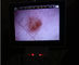 Monitor LCD Digital Video Otoskop Oftalmoskopu Na badanie kliniczne Human Body