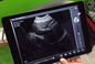 Ipad Ultrasound Scanner Bezprzewodowa sonda ultradźwiękowa Tylko złącze USB o masie 308 g