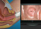 Mini-kolposkopia z endoskopem cyfrowym i samokontrolą z zakresem obserwacji 70 ~ 100 mm