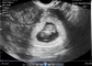 Przenośny skaner ciążowy przezpochwowy do przenośnego ultrasonografu OB / GYN