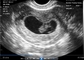 Przenośny skaner ciążowy przezpochwowy do przenośnego ultrasonografu OB / GYN