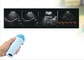 Ręczny przenośny skaner pęcherza Mikro wypukła sonda ultradźwiękowa ciąża weterynaryjna