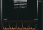 Kolorowy Doppler Przenośny kieszonkowy skaner ultrasonograficzny do MSK piersi tarczycy