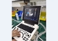 Przenośna ultrasonograficzna maszyna diagnostyczna Laptop Sonda Color Doppler Equipment