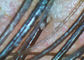Kontrola skóry / włosów Z otoskopiem cyfrowym z 200-krotnym powiększeniem