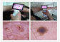 Kliniczna ENT Inspekcja ludzkiego ciała Digital Video Otoskop z kolorowym TFT LCD USB Otoskop