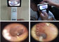 1920 x 1080 pikseli CMOS Smart Medical USB Video Otoskop do uszu skóry i ogólnego obrazowania