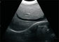 Przenośny Ciąża Ultrasound Scanner Intelligent Zoom, 12 &amp;quot;LCD Ręcznie wykonywane z sondą 3.5MHz wypukły