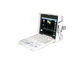 Full Digital Portable Color Ultrasound Scanner Ekonomiczny kolorowy ultrasonograficzny doppler z funkcją PW