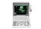 Cyfrowy przenośny mobilny laptop Ultrasound Scanner Sprzęt medyczny BIO 3000J z ekranem LED o przekątnej 1,12 cala
