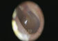 Neutralne białe światło Digital Video Otoskop Dermatoskop i Otoskop kamera o wysokiej rozdzielczości