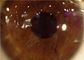 Ręczna lampa szczelinowa Przenośna kamera oftalmoskopowa