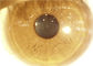 Ręczna lampa szczelinowa Przenośna kamera oftalmoskopowa
