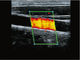 Diagnostyczny ręczny skaner ultradźwiękowy Bezprzewodowy z 8 regulacjami TGC