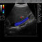 Przenośna kolorowa ultrasonografia dopplerowska z oprogramowaniem do pomiarów i obliczeń