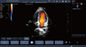 Kolorowy, ultrasonograficzny skaner dopplerowski z mutilem językowym z sondą mikrowypukłą
