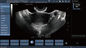 Przezpochwowe kolorowe badanie ultrasonograficzne dopplerowskiej sondy, ręczna ciąża dopplerowska