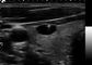 Przenośna ultrasonograf Doppler o wysokiej rozdzielczości z 6 calowym ekranem dotykowym