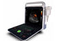 4d Ultrasound Machine Przenośny skaner ultradźwiękowy Z sondą 3D i fazowaną opcjonalnie