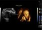 Przenośny ultrasonograf Doppler Przenośny ultrasonograf Sonda 3D 4D Opcjonalnie